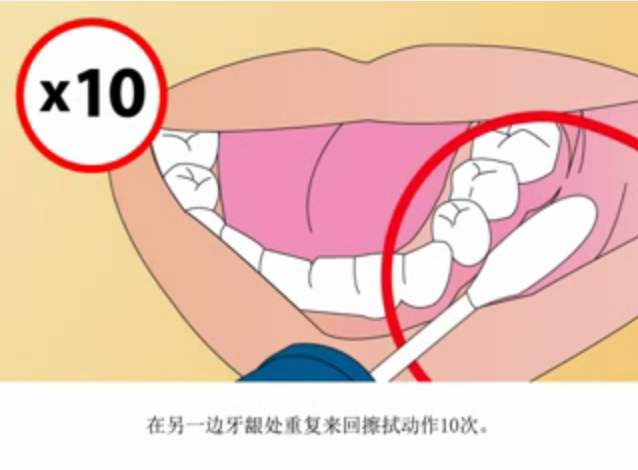 口腔拭子样本采集方法